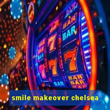 smile makeover chelsea