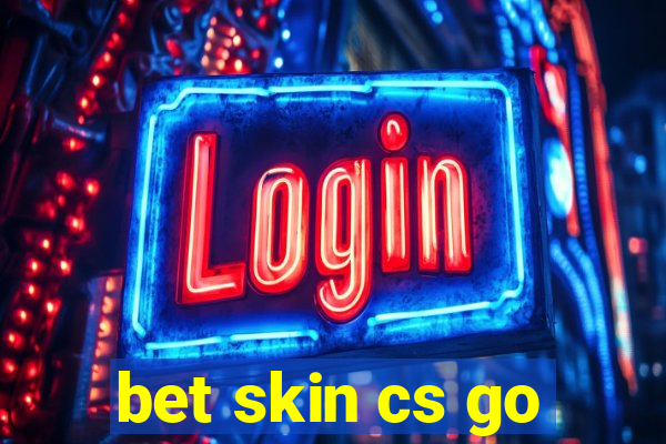 bet skin cs go