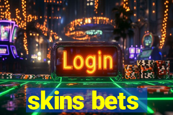 skins bets