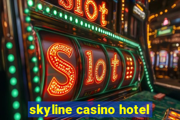 skyline casino hotel